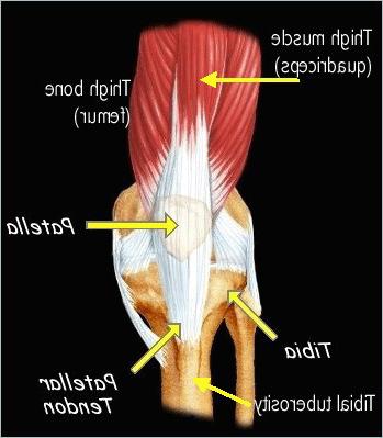 Diagram of the knee, indicating the location of the patella, tibia and patellar tendon